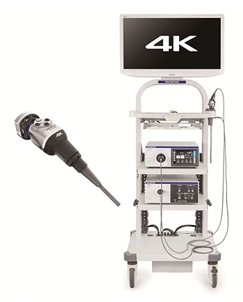 4K技術搭載の外科手術用内視鏡システムの写真