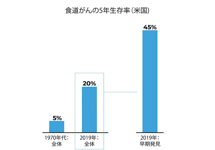 食道がんの5年生存率（米国） 1970年代全体：5%　2019年全体：20%　2019年早期発見：45%