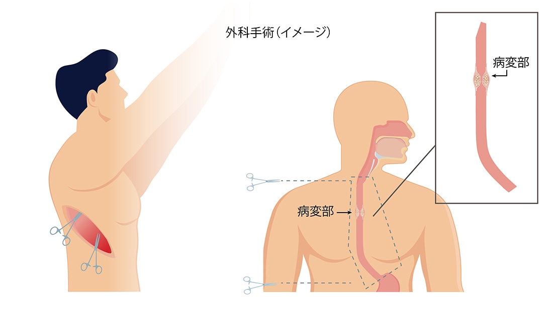 外科手術（イメージ）