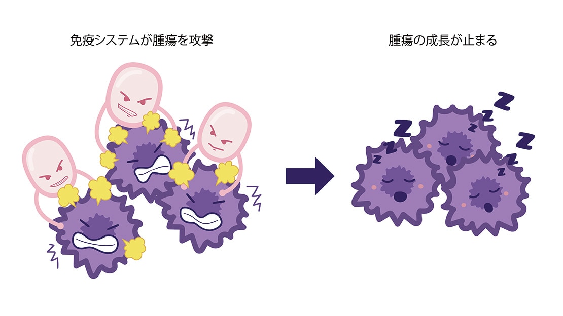 免疫システムが腫瘍を攻撃、腫瘍の成長が止まる