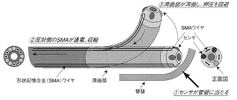 能動湾曲カテーテルの原理