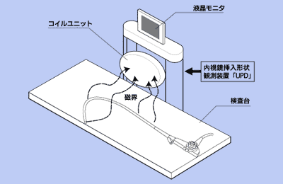 「挿入形状検出の原理」