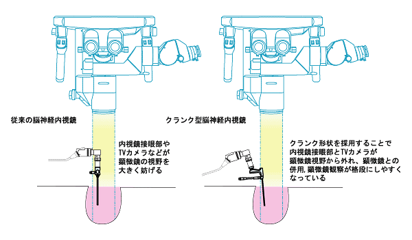 手術用顕微鏡の視野干渉防止