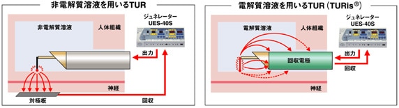 非電解質溶液を用いるTUR　電解質溶液を用いるTURis