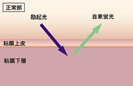 正常部