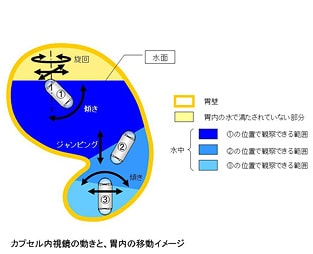 カプセル内視鏡の動きと、胃内の移動イメージ