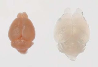 マウス脳（左）と「SCALEVIEW-A2」に2週間浸漬したマウス脳（右）