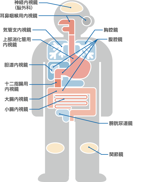 使用される内視鏡の種類：神経内視鏡（脳外科）、耳鼻咽喉用内視鏡、胸腔鏡、気管支内視鏡、上部消化管用内視鏡、腹腔鏡、胆道内視鏡、十二指腸用内視鏡、大腸内視鏡、小腸内視鏡、膀胱尿道鏡、間接鏡