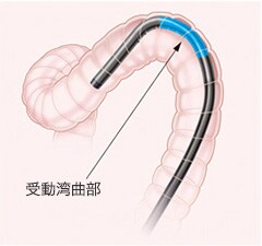 内視鏡ビデオスコープシステム Evis Lucera Elite 患者さまにはよりやさしく 先生にはより扱いやすく 製品技術 オリンパス 内視鏡ビデオスコープシステム Evis Lucera Elite 患者さまにはよりやさしく 先生にはより扱いやすく 製品技術 オリンパス